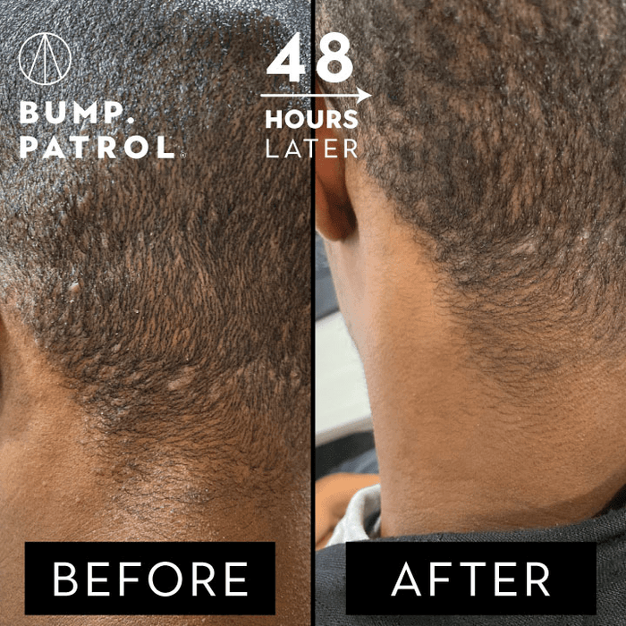 Bump Patrol - Original Aftershave Treatment - 57ml