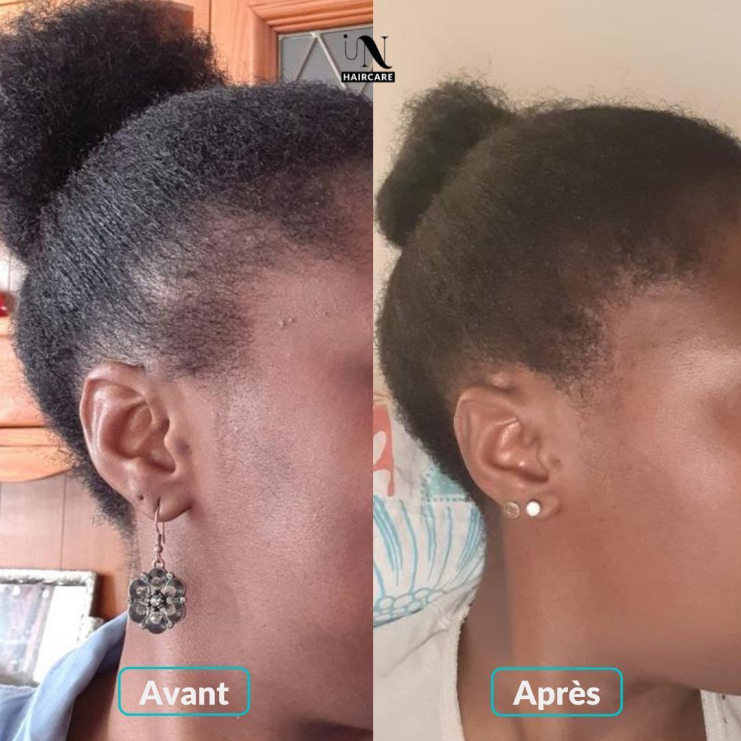 In Haircare | Gélules pour la pousse des cheveux (cure 1 mois)