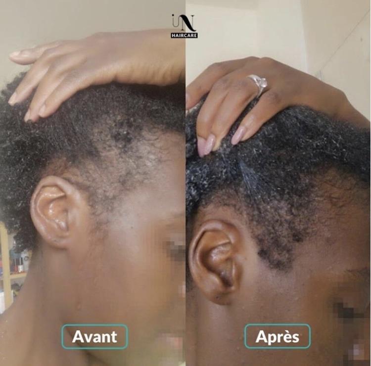Les célèbres compléments alimentaires In Haircare, en gélules. Lot de 3 flacons soit 3 mois de cure (la durée minimale conseillée pour obtenir des résultats solides)