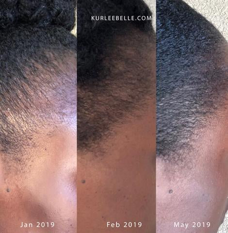 Le Tropical Oils Blend est un somptueux mélange d'huiles tropicales restaure les cheveux secs et abîmés. Il est idéal en bains d'huiles ou en massage sur le cuir chevelu pour activer la pousse.